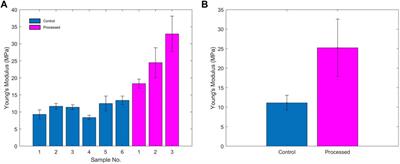 Biomechanical Evaluation of Decellularized and Crosslinked Corneal Implants Manufactured From Porcine Corneas as a Treatment Option for Advanced Keratoconus